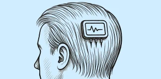 Mikroiğneli Elektrot Teknolojisi | Sensörler Saç Telleri Arasında